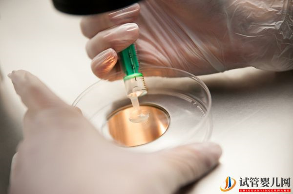 國(guó)內(nèi)精子庫(kù)精子做試管費(fèi)用明細(xì)(圖3) 國(guó)內(nèi)精子庫(kù)精子做試管費(fèi)用明細(xì)(圖3)