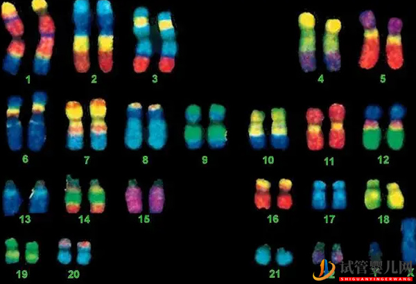 4號(hào)染色體異常的后果 - 缺失綜合征、三體重復(fù)的原因分析(圖2)