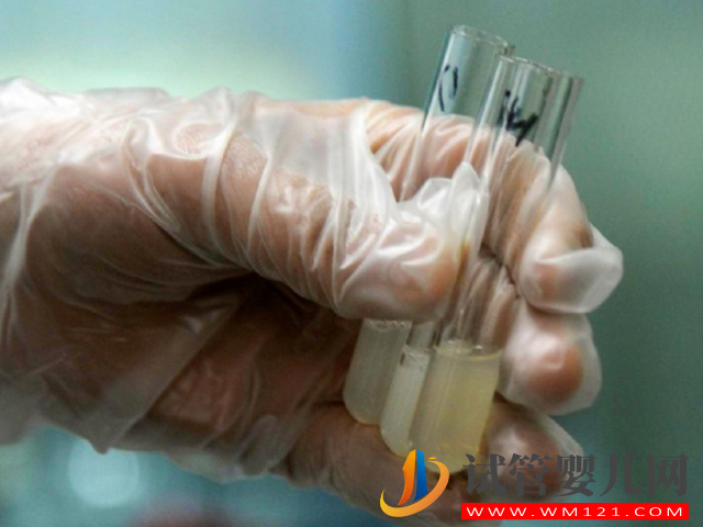 男性不育癥精子dna碎片檢測費用明細，不同醫院收費標準不等(圖3)