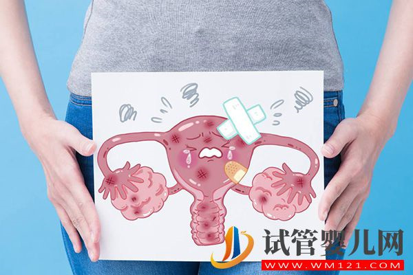 巧囊快速自然懷孕方法有3種，術后盡快同房單側也能受孕(圖3)