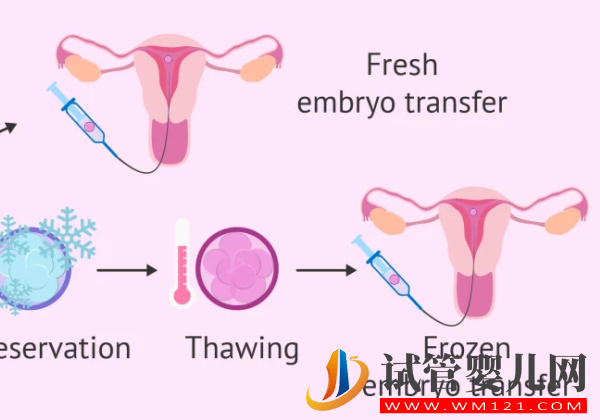 試管移植后當天開車回家影響真不大，會導致著床失敗是謠言(圖1)