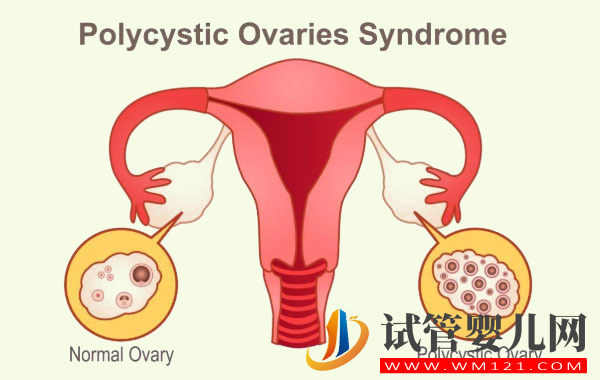 多囊卵巢服用維生素E的正確吃法：從月經(jīng)期開始對身體有好處(圖1)