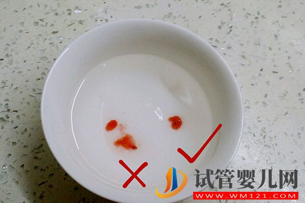 教你10招判斷孩子是否親生，外貌、血型等土方法可了解(圖3)