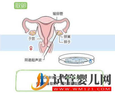 試管嬰兒流程步驟說明(圖7)