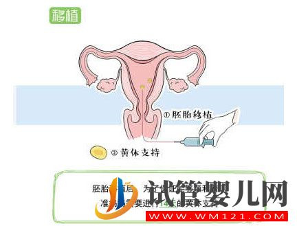 試管嬰兒流程步驟說明(圖8)