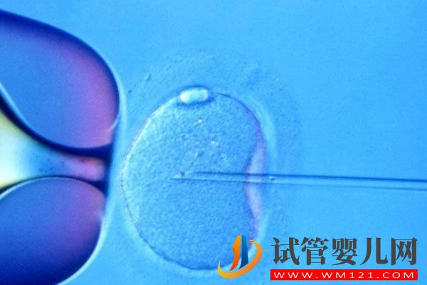 三代試管胚胎篩查時間不統一，45天才出結果原因有這些(圖2)