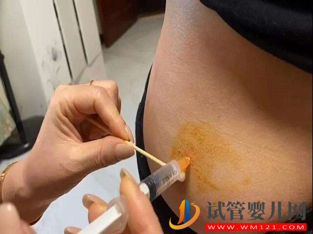 試管嬰兒移植胚胎前在肚子上“打拼針”是打什么藥?(圖1) 試管嬰兒移植胚胎前在肚子上“打拼針”是打什么藥?(圖1)