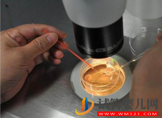 做試管嬰兒的夫妻請注意：你們有沒有丟過胚胎？(圖1)