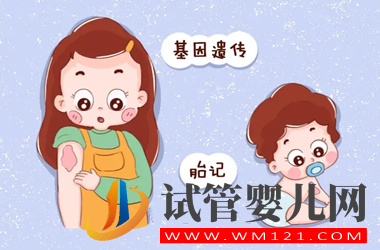 胎記遺傳的可能性大嗎?試管嬰兒會長胎記嗎?(圖1)