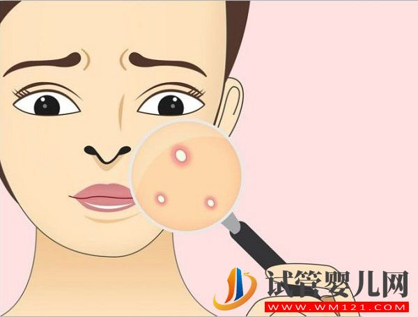 美卓樂與強(qiáng)的松對比分析，3大區(qū)別告訴你哪個(gè)好(圖2)