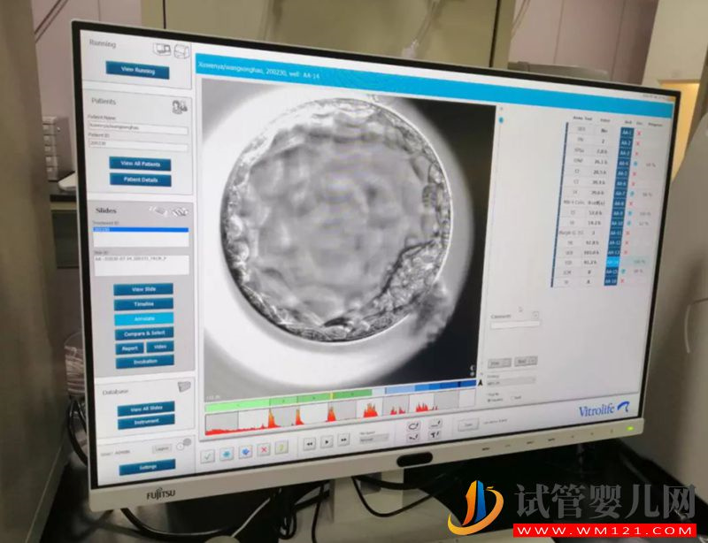 試管寶寶的“家”是怎樣的？ 走進胚胎實驗室一探究竟(圖2)