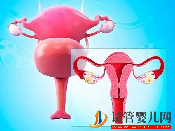 女性檢查出子宮畸形可以懷孕生子嗎？(圖1)