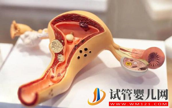 子宮腺肌癥射頻治療效果不佳，中醫(yī)+飲食調(diào)理可能更好(圖2)