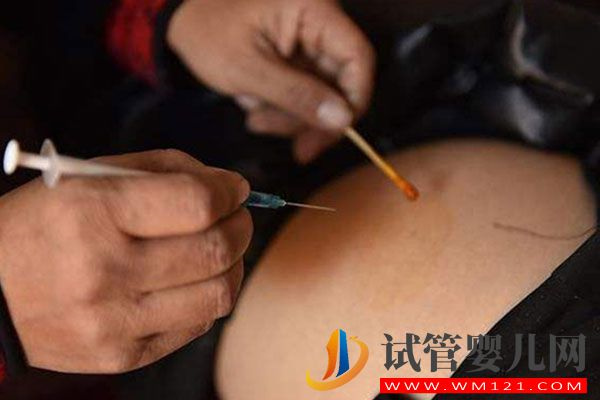 hmg治療卵泡萎縮效果好，注射也需謹(jǐn)慎(圖2)