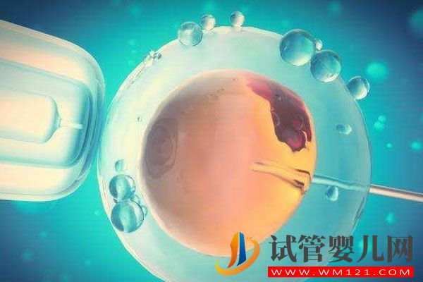 卵巢囊腫對試管助孕有影響嗎？聽聽專家怎么說(圖1)