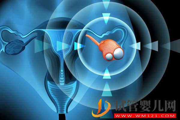 卵巢囊腫對試管助孕有影響嗎？聽聽專家怎么說(圖2)