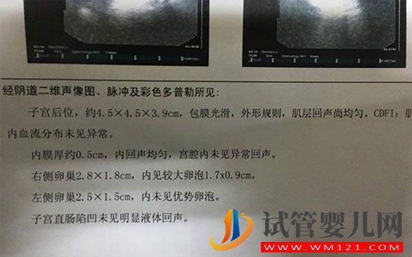 如何能知道卵泡破還是沒破呢?彩超比b超更直觀(圖1)