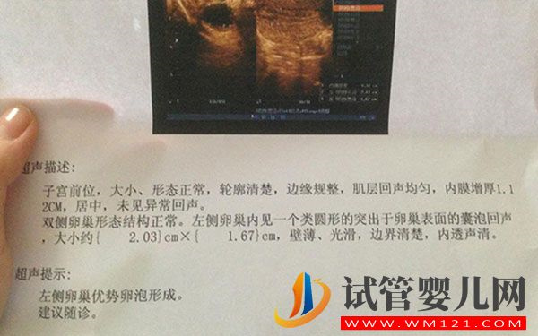 如何能知道卵泡破還是沒破呢?彩超比b超更直觀(圖2)