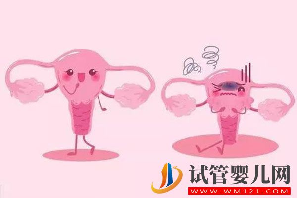 90%的女生都得過陰道炎？到底是怎么來的？(圖2)