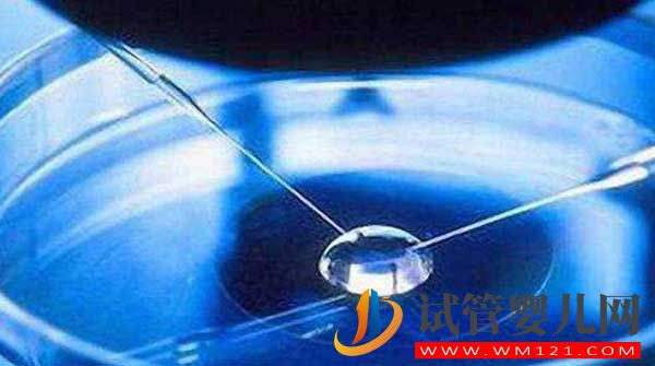 什么是試管嬰兒?從一代到四代看完你就知道了(圖7) 什么是試管嬰兒?從一代到四代看完你就知道了(圖7)