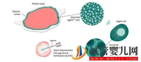 什么是試管嬰兒?從一代到四代看完你就知道了(圖9) 什么是試管嬰兒?從一代到四代看完你就知道了(圖9)