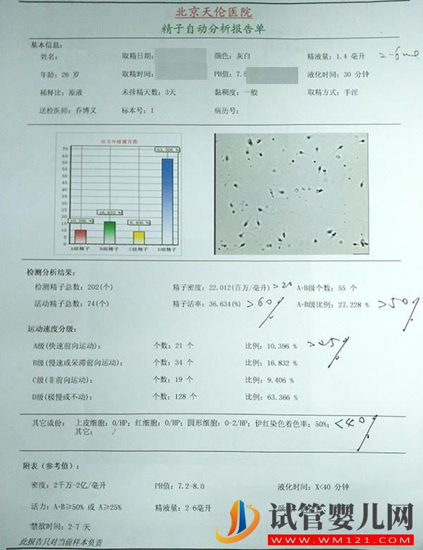常規(guī)精液檢查(圖1)