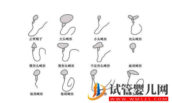 試管嬰兒是用老公的精子嗎？(圖2)