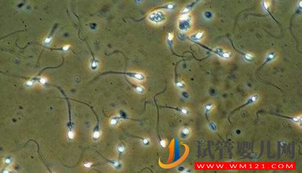 試管嬰兒是用老公的精子嗎？(圖4)