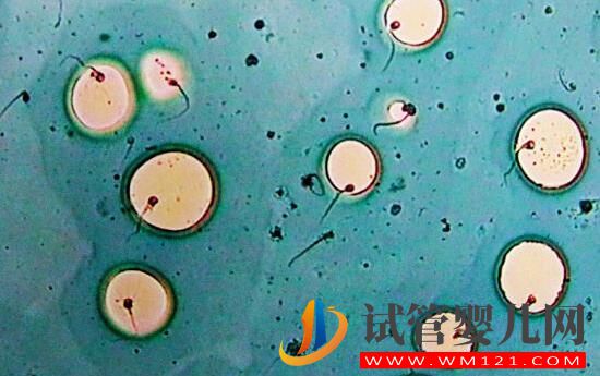 高齡婦女為什么要選擇試管嬰兒？(圖2)