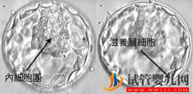 試管嬰兒胚胎選擇看“顏值”，長得好看才能被移植！(圖5)