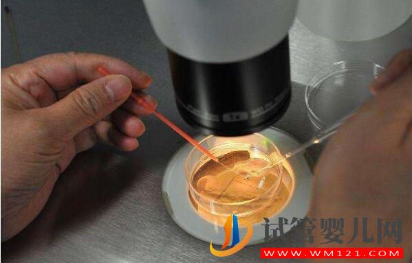 做試管嬰兒取多少個(gè)卵子合適？(圖2)