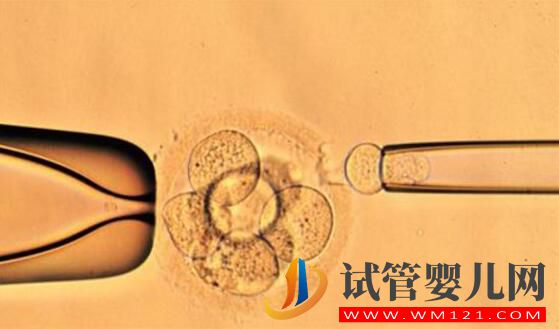 解答做試管嬰兒的人非常擔心的幾個問題(圖6) 解答做試管嬰兒的人非常擔心的幾個問題(圖6)