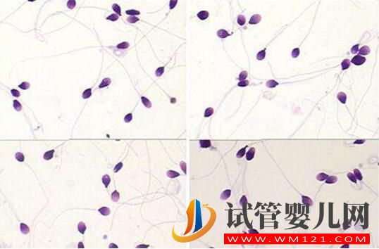 胚胎碎片率的變化對試管嬰兒意味著什么(圖4)