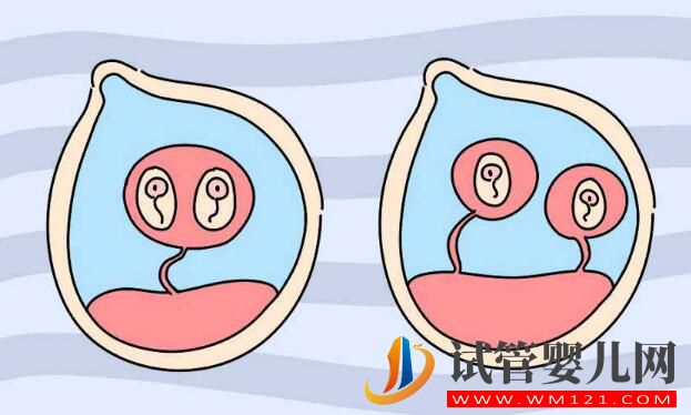 俄羅斯試管嬰兒攻略 看看有哪些你不知道的(圖2) 俄羅斯試管嬰兒攻略 看看有哪些你不知道的(圖2)