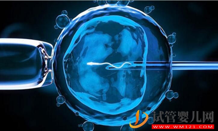俄羅斯試管嬰兒攻略 看看有哪些你不知道的(圖1) 俄羅斯試管嬰兒攻略 看看有哪些你不知道的(圖1)