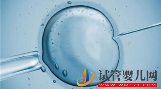 俄羅斯試管嬰兒攻略 看看有哪些你不知道的(圖4) 俄羅斯試管嬰兒攻略 看看有哪些你不知道的(圖4)