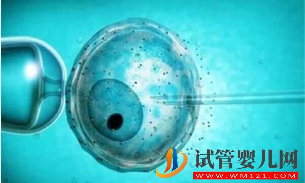 俄羅斯試管嬰兒攻略 看看有哪些你不知道的(圖5) 俄羅斯試管嬰兒攻略 看看有哪些你不知道的(圖5)