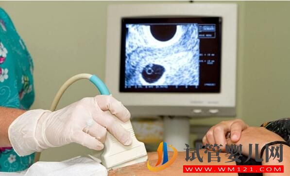 做試管嬰兒,大齡女性如何選擇促排方案?(圖3) 做試管嬰兒,大齡女性如何選擇促排方案?(圖3)