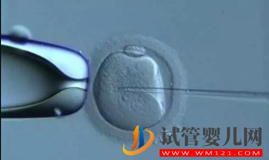 試管嬰兒做一代好還是二代好？(圖2)