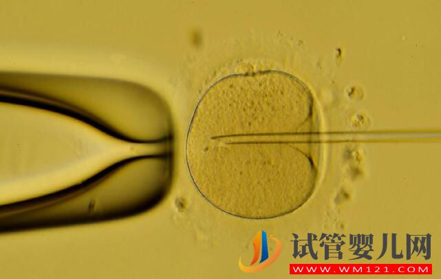 做試管嬰兒之后再次自然懷孕是怎么回事(圖1)