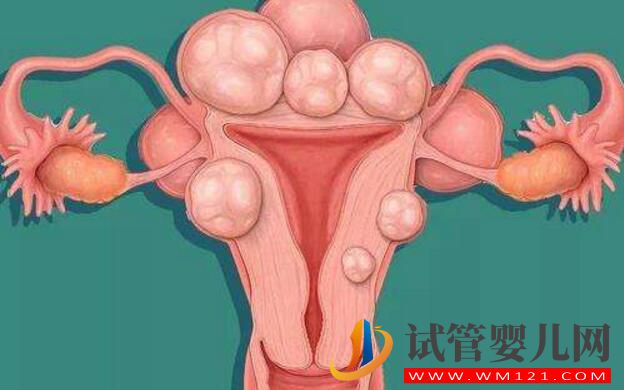 做試管嬰兒對子宮環境有哪些要求？(圖2)