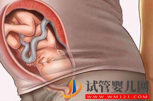 做試管嬰兒的全部流程和費用 全部做完要多長時間(圖2)