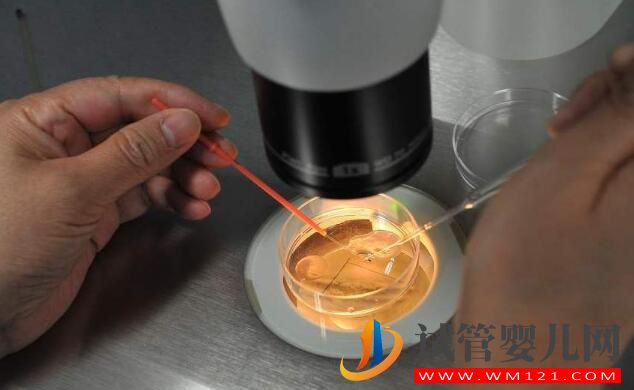 做試管嬰兒前后注意事項有哪些 準(zhǔn)備工作要怎么做(圖2)