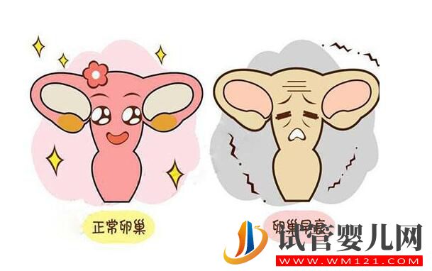 卵巢早衰去泰國(guó)做試管嬰兒的成功率如何?(圖2) 卵巢早衰去泰國(guó)做試管嬰兒的成功率如何?(圖2)