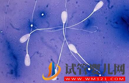 為什么試管的費用會因人而異？如何減少做試管的花費？(圖2)