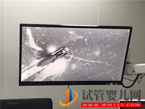 左側卵巢被割除、三次試管失敗她該怎么辦？(圖2)