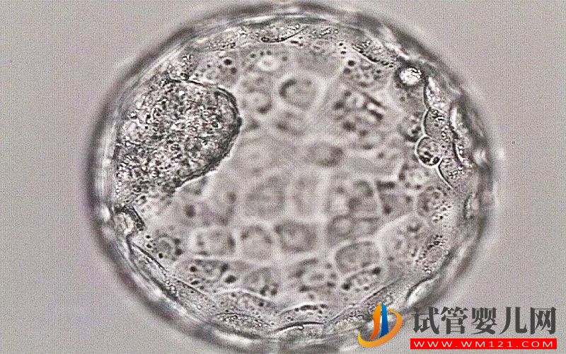 做試管養囊失敗的原因有哪些(圖1)