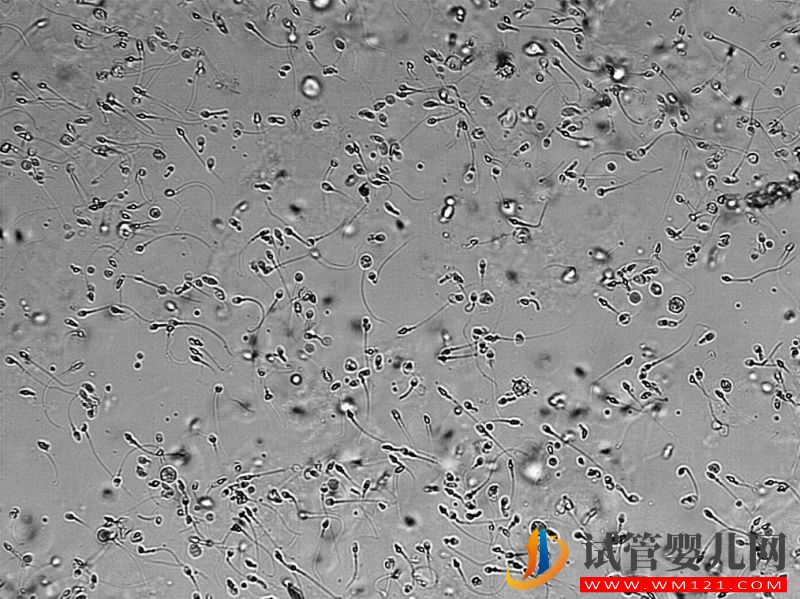 1646375876153582.jpg 想生兒子怎么備孕才能讓男性的Y精子增多(圖1)
