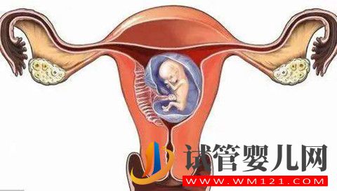 1640762155156893.jpg 影響試管嬰兒成功率因素之的子宮內(nèi)膜容受性因素解析(圖2)