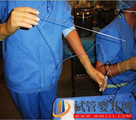 做試管嬰兒取卵痛不痛?不麻醉半麻和全麻有哪些區(qū)別?(圖2)